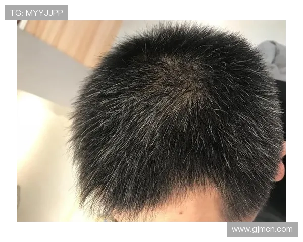 库尼亚直言不在意蓄发哥的头发